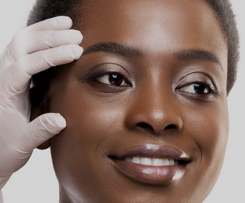 hormones and glaucoma