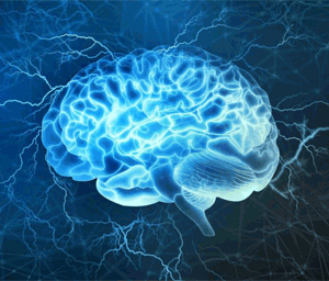 Brain xray